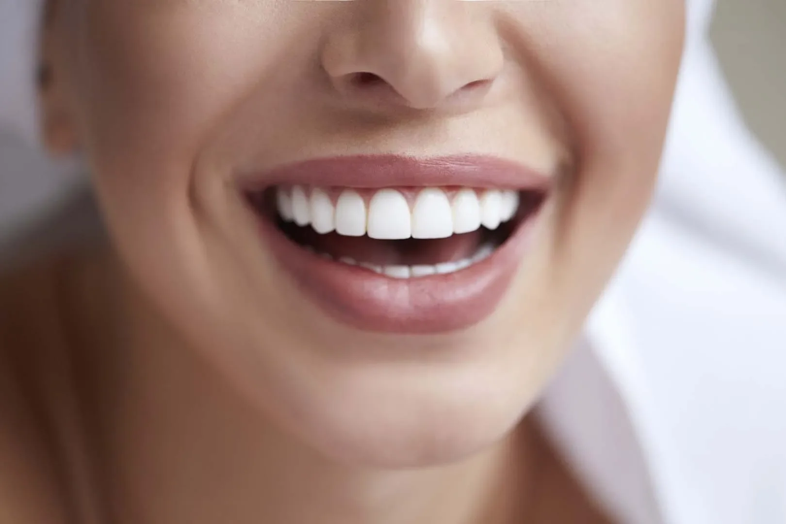 Professional teeth whitening
