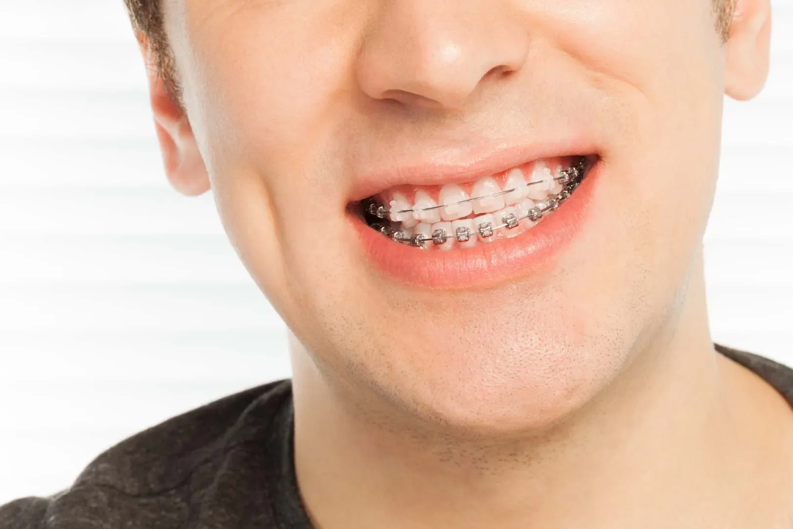 Orthodontic screening visit at Berry Road Dental