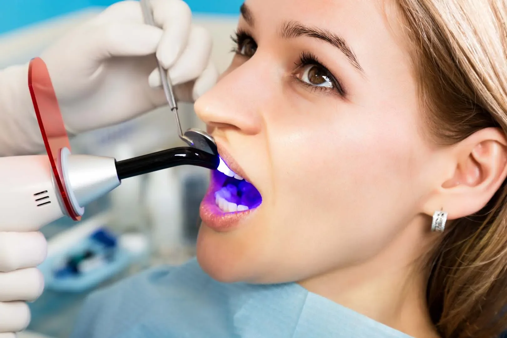 Tooth-colored filling appointment at Berry Road Dental