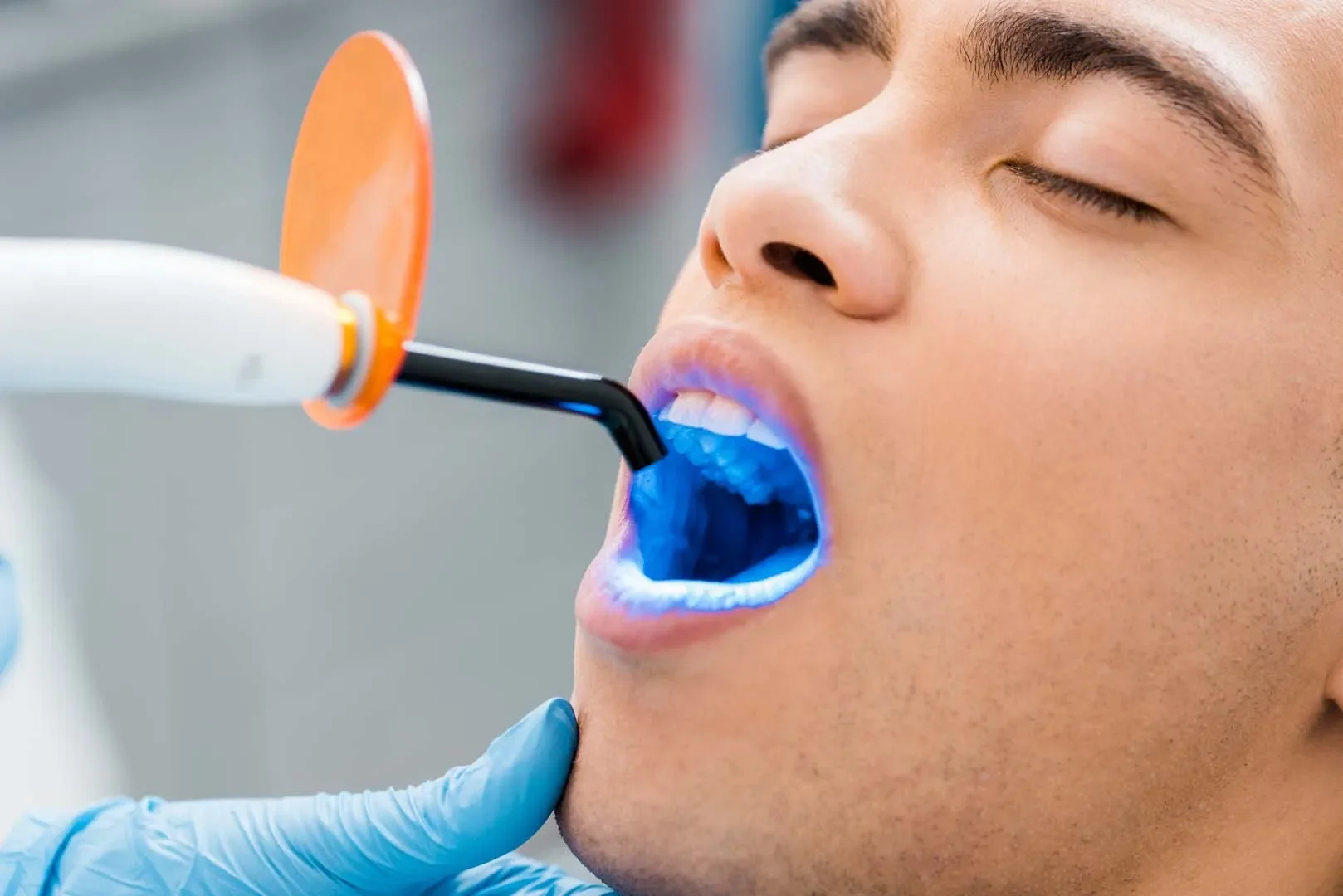 Dental sealant cost in Norman, OK